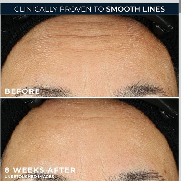 🆕 NIB Retinol Correxion Line Smoothing Night Serum (30) Capsules 🤩 - Picture 3 of 13